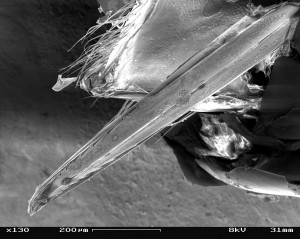 1024px-Vespula_vulgaris_SEM_Sting_01