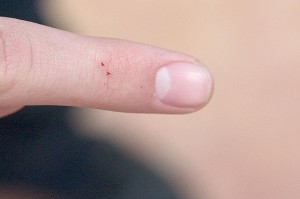 black widow bite, DAvid o flicker