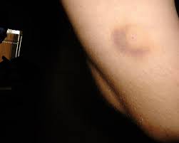 spider bite, pac dog flicker
