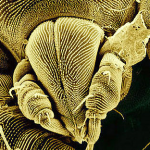 mite mouth parts