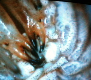 Harvestman Mouthby Modulok