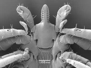 Nymph_03_ventral_x160_capitulum dartmoor tick watch